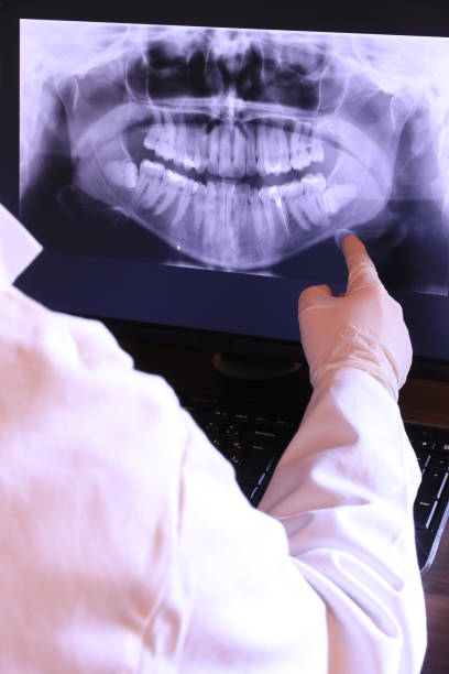 Best Emergency Dental Surgery in Nanticoke, PA