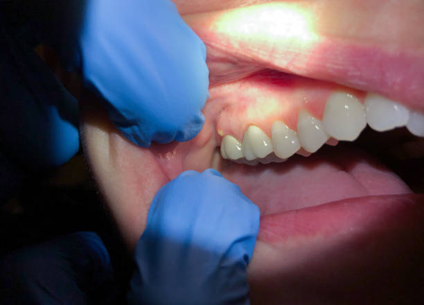 Best Emergency Treatment for Toothache in Nanticoke, PA