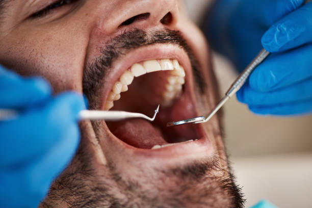 Best Emergency Broken Tooth Repair in Nanticoke, PA