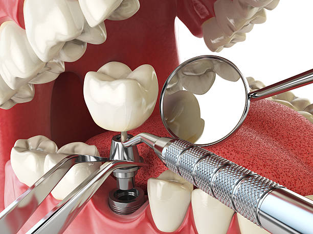 Best Emergency Orthodontic Repairs in Nanticoke, PA